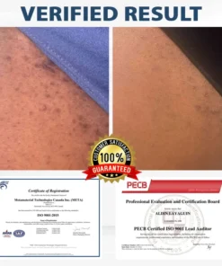 Fivfivgo® LicorRelief Man Genital Antifungal Cream