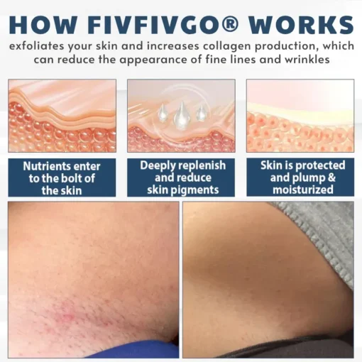 Fivfivgo® LicorRelief Man Genital Antifungal Cream