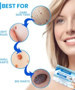 Fivfivgo™ Maximum Performance Ointment for the Immediate removal of Warts