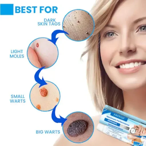 Fivfivgo™ Maximum Performance Ointment for the Immediate removal of Warts