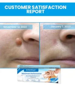 Fivfivgo™ Maximum Performance Ointment for the Immediate removal of Warts