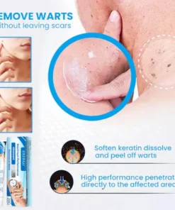 Fivfivgo™ Maximum Performance Ointment for the Immediate removal of Warts
