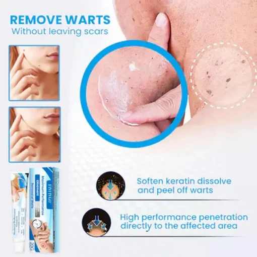 Fivfivgo™ Maximum Performance Ointment for the Immediate removal of Warts