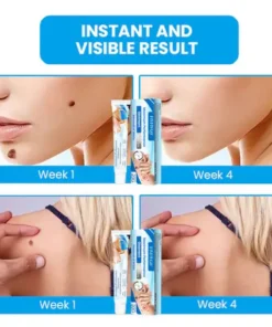 Fivfivgo™ Maximum Performance Ointment for the Immediate removal of Warts