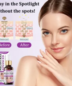 Fivfivgo® MelantraX Advanced Anti-Hyperpigmentation Essence