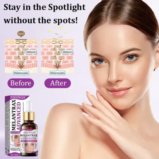 Fivfivgo® MelantraX Advanced Anti-Hyperpigmentation Essence