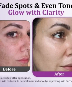 Fivfivgo® MelantraX Advanced Anti-Hyperpigmentation Essence