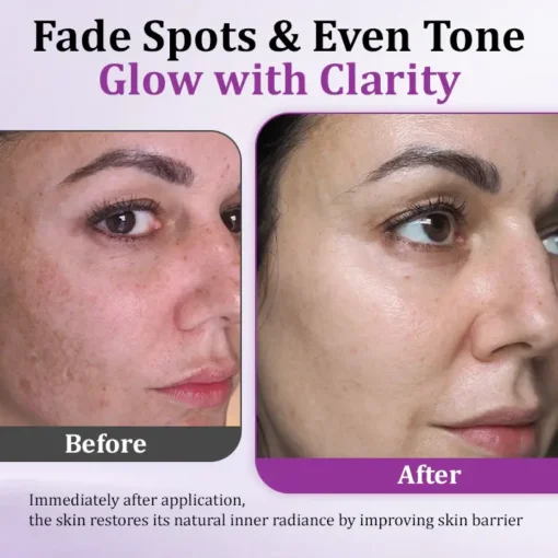 Fivfivgo® MelantraX Advanced Anti-Hyperpigmentation Essence