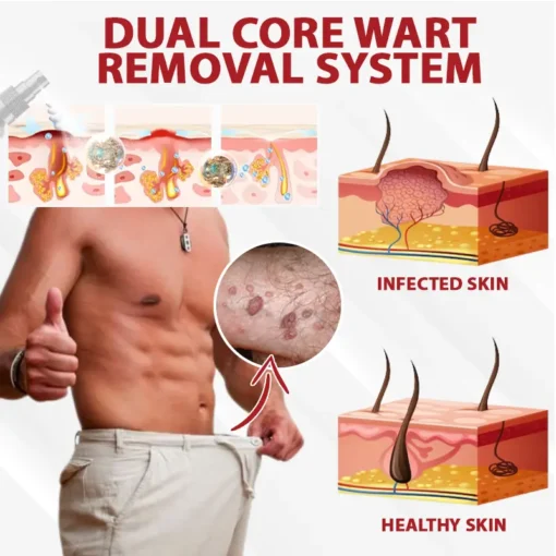 Fivfivgo® Men's HPV Warts Care Spray