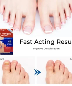 Fivfivgo® Nail Fungus Care Patches