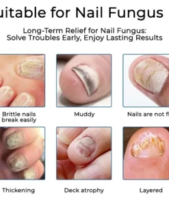 Fivfivgo® Nail Fungus Care Patches