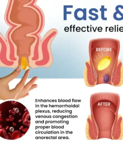 Fivfivgo® Natural Hemorrhoid Capsules