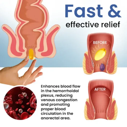 Fivfivgo® Natural Hemorrhoid Capsules