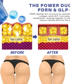 Fivfivgo® PDRN-GLP-1 Cellulite Targeting Reedle Shot Gel