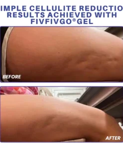 Fivfivgo® PDRN-GLP-1 Cellulite Targeting Reedle Shot Gel