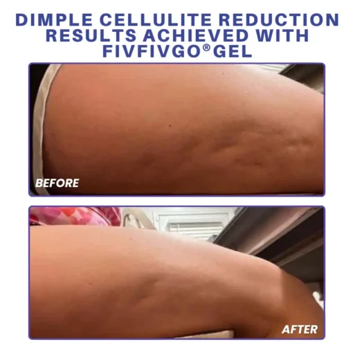 Fivfivgo® PDRN-GLP-1 Cellulite Targeting Reedle Shot Gel