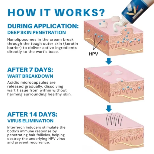 Fivfivgo® PRO HPV Genital Warts Relief Cream