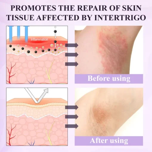 Fivfivgo® Purple Corn Multi-Condition Skin Spray
