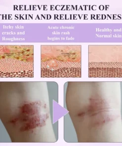 Fivfivgo® Purple Corn Multi-Condition Skin Spray