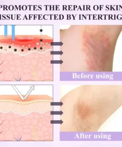 Fivfivgo® Purple Corn Multi-Condition Skin Spray