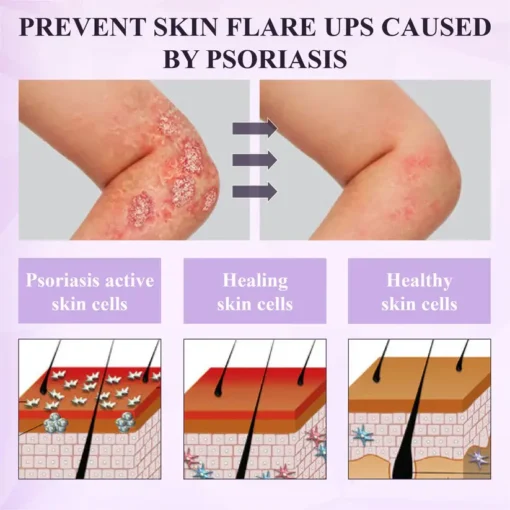 Fivfivgo® Purple Corn Multi-Condition Skin Spray