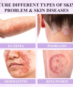 Fivfivgo® Purple Corn Multi-Condition Skin Spray