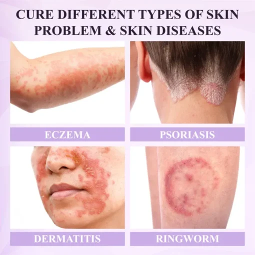 Fivfivgo® Purple Corn Multi-Condition Skin Spray