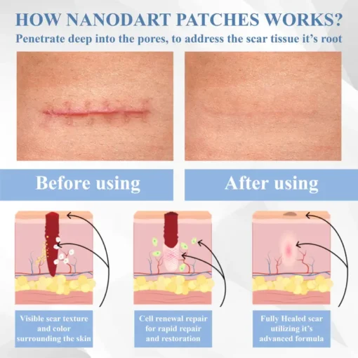 Fivfivgo® ScarRepair EGF Nanodart Patches