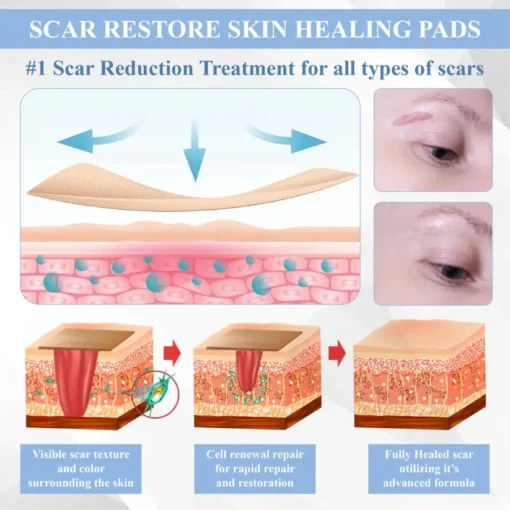 Fivfivgo® ScarRepair EGF Nanodart Patches