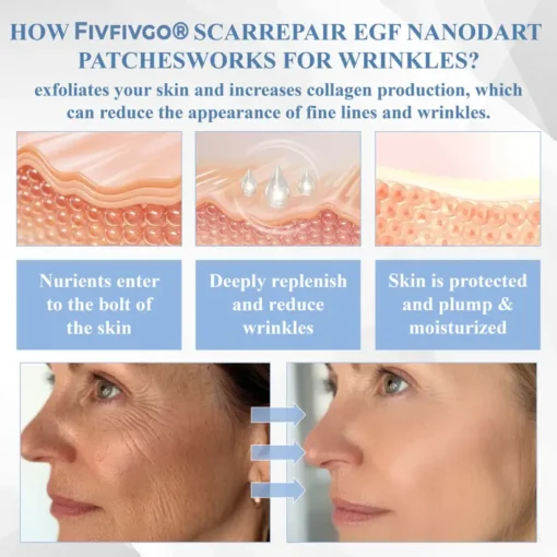 Fivfivgo® ScarRepair EGF Nanodart Patches