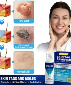 Fivfivgo® TagRecede Cryo Treatment Spray
