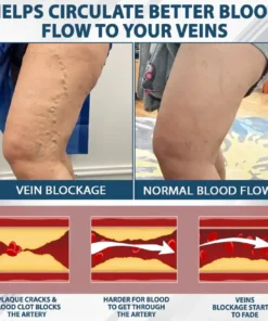 Fivfivgo® VenoHerb Black Cumin Edema Relief Balm