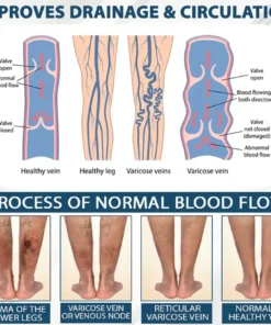 Fivfivgo® VenoHerb Black Cumin Edema Relief Balm