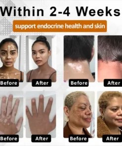 Fivfivgo® VitiBee Skin Rebalancing Cream