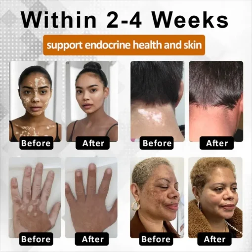 Fivfivgo® VitiBee Skin Rebalancing Cream