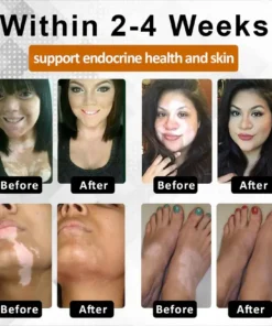 Fivfivgo® VitiBee Skin Rebalancing Cream