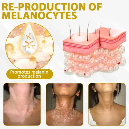 Fivfivgo® VitiBee Skin Rebalancing Cream
