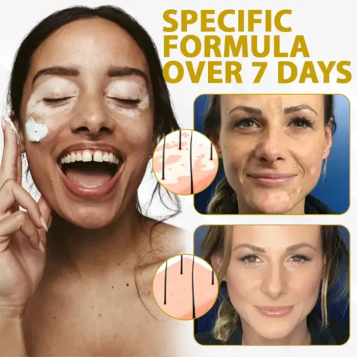 Fivfivgo® VitiBee Skin Rebalancing Cream