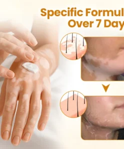 Fivfivgo® VitiCalm Bee Venom Cream