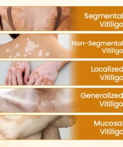 Fivfivgo® VitiCalm Bee Venom Cream