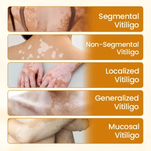 Fivfivgo® VitiCalm Bee Venom Cream