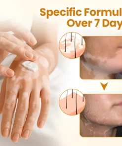Fivfivgo® VitiClear Pro Bee Venom Cream