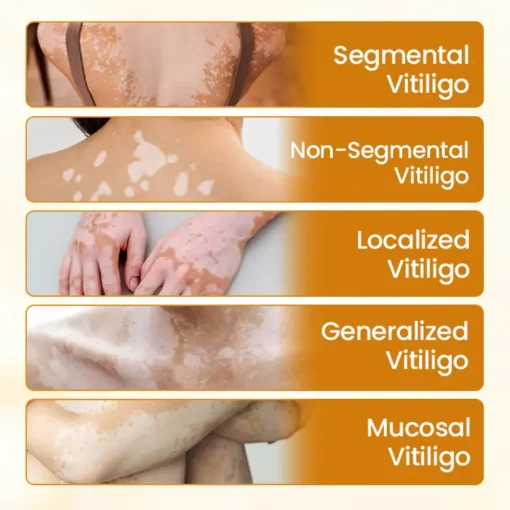 Fivfivgo® VitiClear Pro Bee Venom Cream