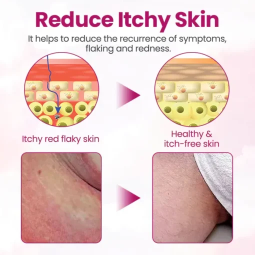 Fivfivgo® Women’s GentY HPV Relief Cream