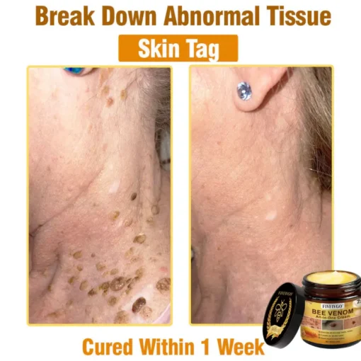 Fivfivgo® Bee Venom All-In-One Cream