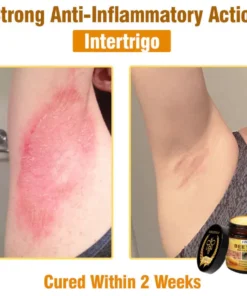 Fivfivgo® Bee Venom All-In-One Cream