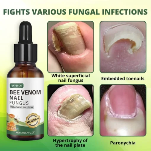 Fivfivgo® Bee Venom Nail Fungus Treatment Solution