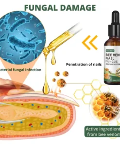 Fivfivgo® Bee Venom Nail Fungus Treatment Solution