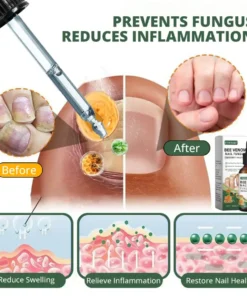 Fivfivgo® Bee Venom Nail Fungus Treatment Solution