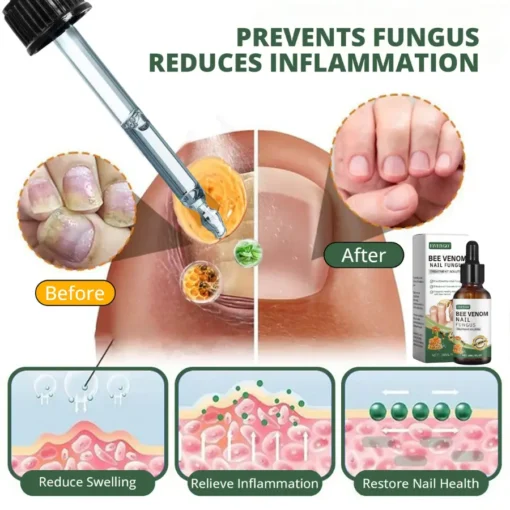 Fivfivgo® Bee Venom Nail Fungus Treatment Solution